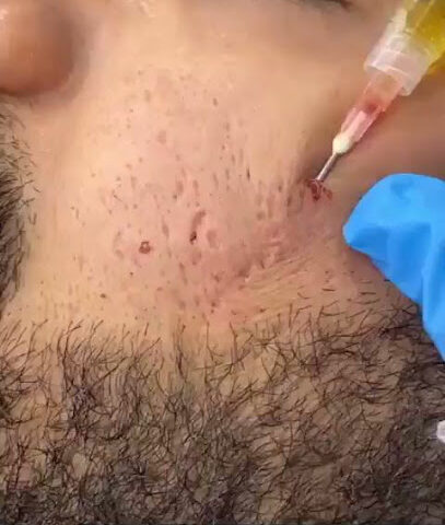 الدكتورة شيماء منصور | جلدية وتجميل وليزر بجدة - Jeddah - +966 54 427 4878