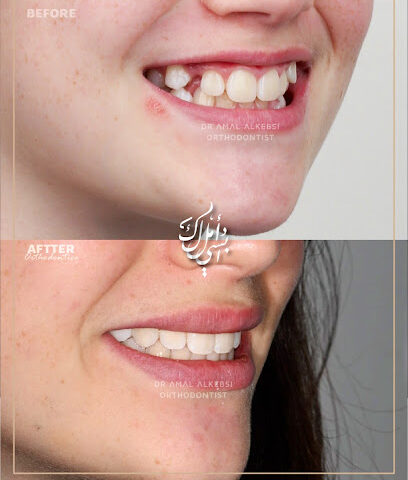 Dr Amal Alkebsi د أمل الكبسي لتقويم الاسنان والفكين / تقويم الانفزلاين Invisalign Certified Orthodontist/ MClinDent in Orthodontics - Al Khobar - +966 13 897 9922