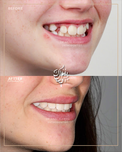 Dr Amal Alkebsi د أمل الكبسي لتقويم الاسنان والفكين / تقويم الانفزلاين Invisalign Certified Orthodontist/ MClinDent in Orthodontics - Saudi Arabia|Al Khobar 34446|Al Aqrabiyah|1 St